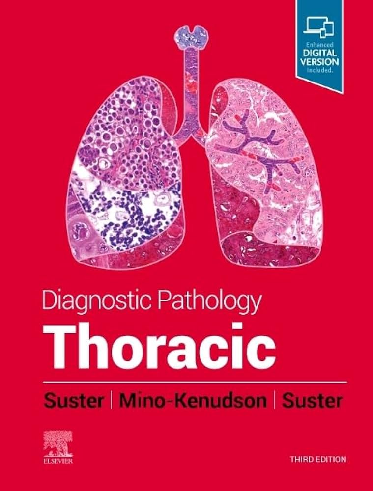 Diagnostic Pathology: Thoracic: 9780323834766: Medicine
